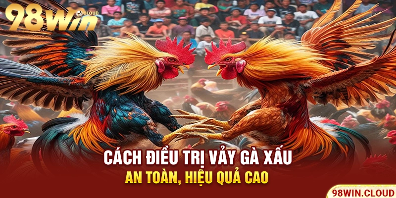 Cách điều trị vảy gà xấu an toàn, hiệu quả cao